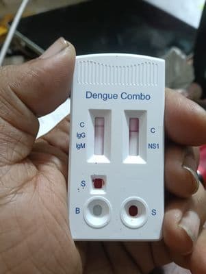 Dengue NS1 Antigen IgG/IgM Antibody Duo Panel Rapid Test_img_2